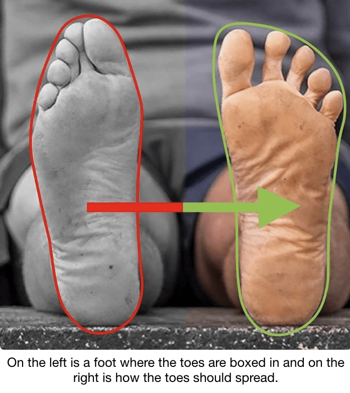 How shoes effect our feet.